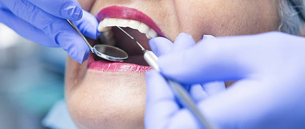 Best Teeth Whitening  in Pocasset, MA